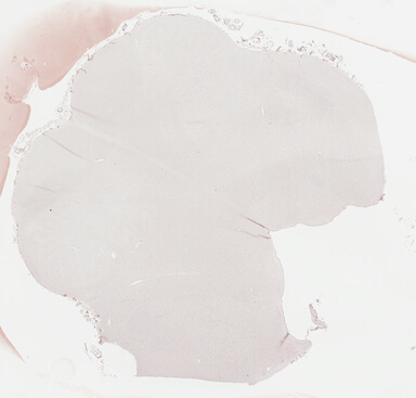 ['deident_ff2efc14-72bf-49a4-ad0f-2196c0f847b5_69b039ab.jpg']