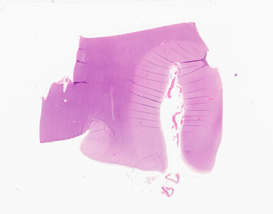 ['deident_58d2243e-3e12-4f57-83de-0a42ff98aa94_69d9355b.jpg']
