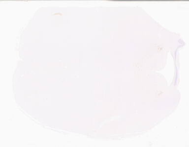 ['deident_84158f15-ba2f-4499-ad74-8f33bf16cf5f_69d93565.jpg']