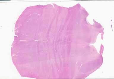 ['deident_309faab6-6ce9-4513-82bc-8a8abd3563ae_69d93545.jpg']