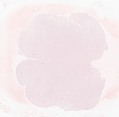 ['deident_afdc559f-48a8-4dcb-8bbf-a7ae0d3e702a_69b05d41.jpg']