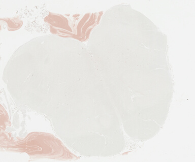 ['deident_dd12a1b5-9030-49fd-9406-3b97db91c229_69b03490.jpg']