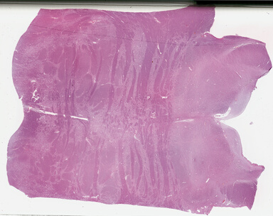 ['deident_f8a86afb-fc38-4b81-ab41-037eb591e074_69b0349e.jpg']