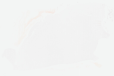 ['deident_49782971-be11-43e5-afe2-f94a4409420c_69b03458.jpg']