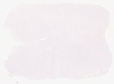 ['deident_e336391a-57a4-4f11-937c-0ddb04d1903b_69b03495.jpg']
