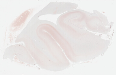 ['deident_522f1989-3cfc-448a-853e-bd12ff226f08_69b0345a.jpg']