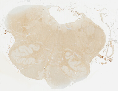 ['deident_924b0025-7aa1-4cf3-9659-9602dd2b8e11_695fd004.jpg']