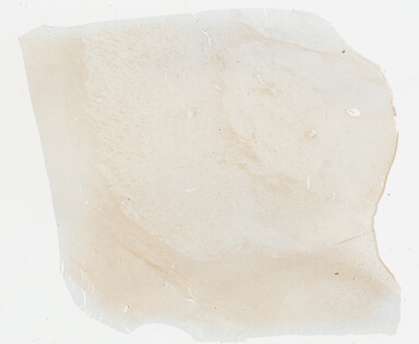 ['deident_17b35866-faf2-46f9-98aa-c077a47c1b12_695fcfe6.jpg']