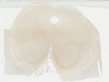 ['deident_fee3cfa7-f66b-4003-a3d9-613ad91323e0_695fd022.jpg']