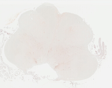 ['deident_ab8cc208-e51b-48a5-8cac-7d57de1ec791_695fd00c.jpg']