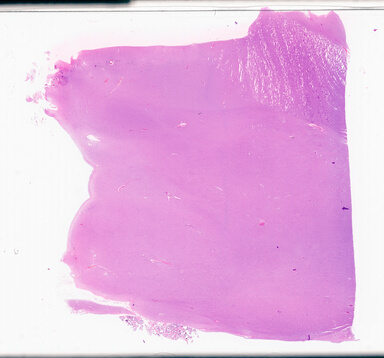 ['deident_d29257ab-de5d-418f-aaf6-362546b4eac6_69d94c39.jpg']