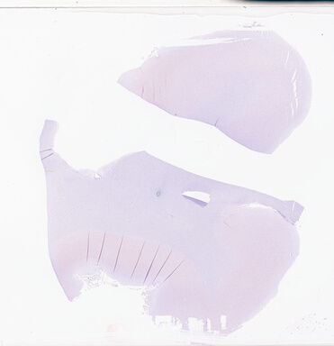 ['deident_af4f50d7-7d17-4d99-bc1d-a2fce017bc8e_69d94c2b.jpg']