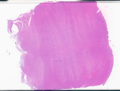 ['deident_b7457376-ab2f-4f47-bebd-f40ed5c42c3e_69d94c30.jpg']
