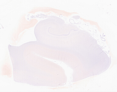 ['deident_a126195c-0e9f-4ebc-95d1-e4f031071548_69d94c23.jpg']