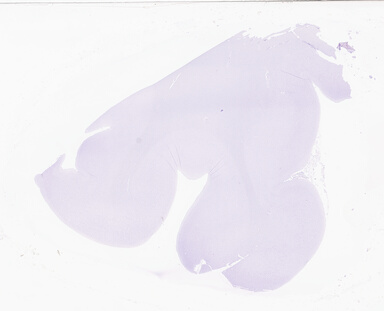 ['deident_58268947-3401-4272-bde6-6d3ce1986d28_69d94bfe.jpg']
