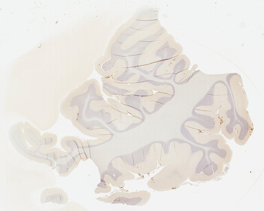 ['deident_04dcbf04-6907-42e9-8bc7-5820991d7598_69b02898.jpg']