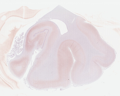 ['deident_41c75de6-54d8-435d-871b-bd775e458a08_695fca7c.jpg']