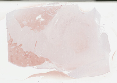 ['deident_d0a0a478-1254-4a0f-9d73-ace3ac6e904f_695fcac9.jpg']