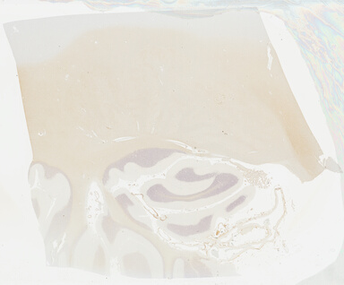 ['deident_d7bd143a-b68b-4255-a445-1c68e9e8f103_695fcaca.jpg']