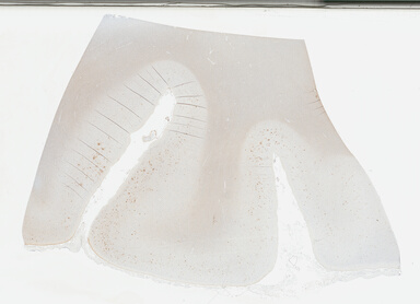 ['deident_f0545c4d-3012-420f-965c-55a471e3560c_695fcace.jpg']