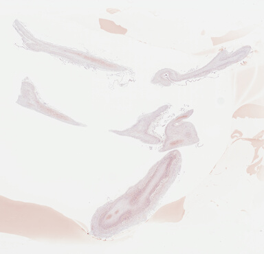 ['deident_d09e974f-e24c-439f-abde-50ad8dbcb9cd_695fcac6.jpg']