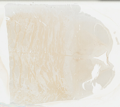 ['deident_a262a1ad-38ee-47be-88f8-fc34cac1eaa4_695fcaac.jpg']