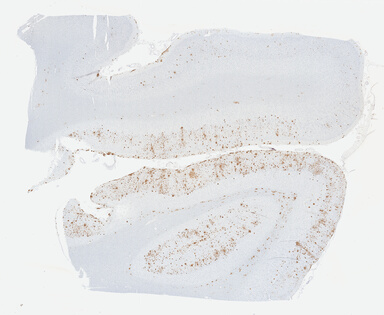 ['deident_01145b54-dcd1-45b4-9746-f67546454595_69b041d3.jpg']