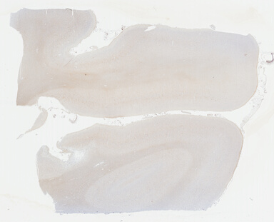 ['deident_7bb61a4f-277c-480d-a54b-92b2ca66ee62_69b041ff.jpg']