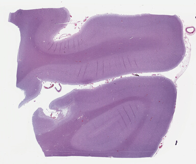 ['deident_a67c1309-3ebc-4caa-8561-287e66360f3f_69b0420b.jpg']