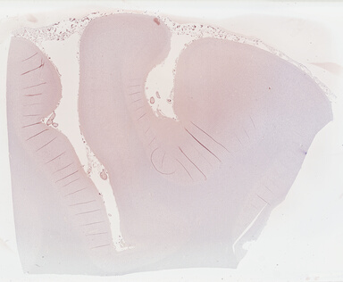 ['deident_30d5d2a5-2c28-4d26-aaa9-9691345ab4e7_69b041e5.jpg']