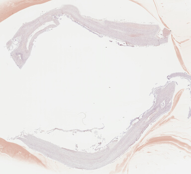 ['deident_099447c5-620a-4d52-aeec-b869de28512e_69b041d6.jpg']