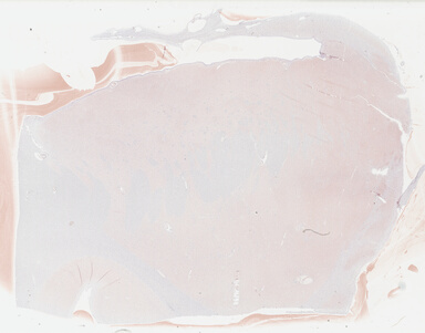 ['deident_10e5a359-f32f-4dfd-b935-7cf257cf27da_69b041db.jpg']