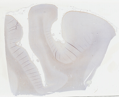 ['deident_7c76aec2-00d6-4a2b-9e0a-2e8c5e02946c_69b04201.jpg']