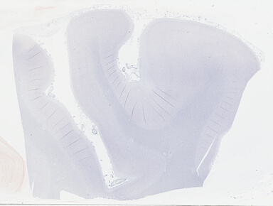['deident_06f5747a-e2bd-473e-949f-542551847b78_69b041d5.jpg']