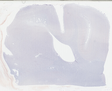 ['deident_ce7eec1d-3af7-409c-b1b0-eea55b5597db_69b04215.jpg']