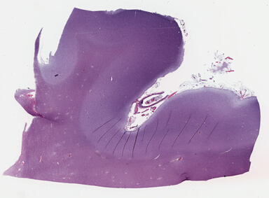 ['deident_74b33439-c35b-43bd-a5ce-f2a316bc6ce9_69b041fe.jpg']