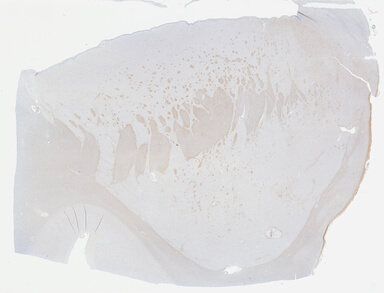 ['deident_d3cefb9c-9714-4a13-a787-c8fd13b8fa8a_69b0421c.jpg']