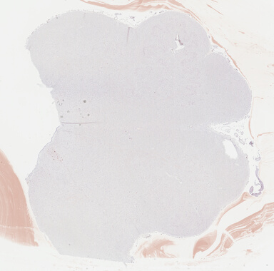 ['deident_34de2699-b1cd-4ca7-bec8-4b2af8f80192_69b041eb.jpg']