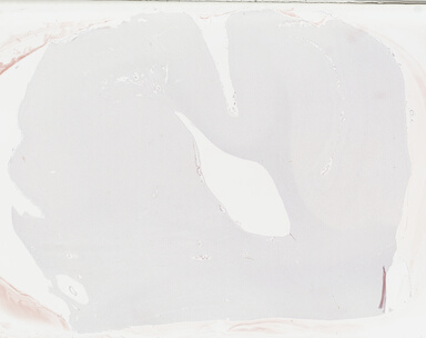 ['deident_ae4d379f-7535-4746-88f4-920927ab0230_69b0420c.jpg']