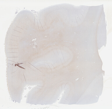 ['deident_19bba8f3-c77e-4730-b8d9-f3ac39ef58f3_69b041e0.jpg']