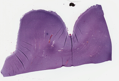 ['deident_bcfc3c75-47a2-484c-8e0d-40da62ff9fd5_69b0420f.jpg']