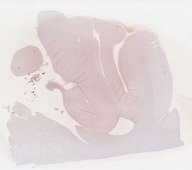 ['deident_c99c500b-dbd1-4842-8179-81e8bb42d890_69b04213.jpg']