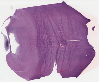 ['deident_ddf04bb1-1e6e-4774-8b91-66777460155c_69b04221.jpg']