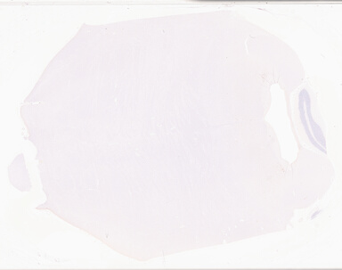 ['deident_cf2f975e-f3eb-4e44-898a-0b20b1a533fe_69b04218.jpg']