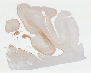 ['deident_dfc4fe1e-c364-4208-a902-3b5e89348179_69b04223.jpg']