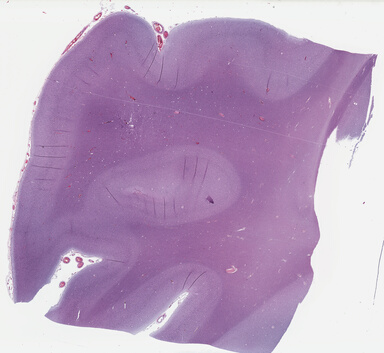 ['deident_6aced6b5-4ec9-48b6-865c-a594747ddd04_69b041fa.jpg']