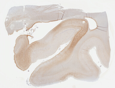 ['deident_ceb754ce-900c-46d4-9ee5-ff1065b76e8e_69b04217.jpg']