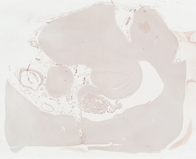 ['deident_f5fe7220-e17d-492a-9750-6292ad25326c_69b03e31.jpg']