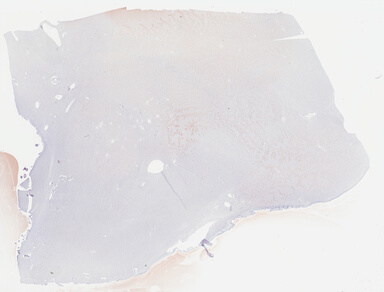 ['deident_bede81f9-0bea-4f2b-b493-4a5091ff2c10_69b03e1b.jpg']