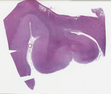 ['deident_a11c17ed-4b97-42f0-b64f-d8d18e2feece_69b03e16.jpg']